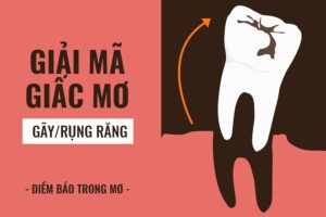 Giải Mã Giấc Mơ Rụng Răng Tại Yo88: Báo Hiệu Gì Cho Người Chơi