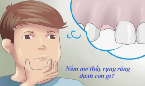 Giải Mã Giấc Mơ Rụng Răng Tại Yo88: Báo Hiệu Gì Cho Người Chơi