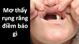 Giải Mã Giấc Mơ Rụng Răng Tại Yo88: Báo Hiệu Gì Cho Người Chơi